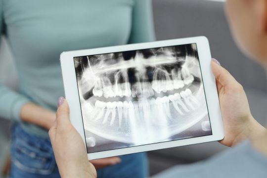digital implantology phoenix dental