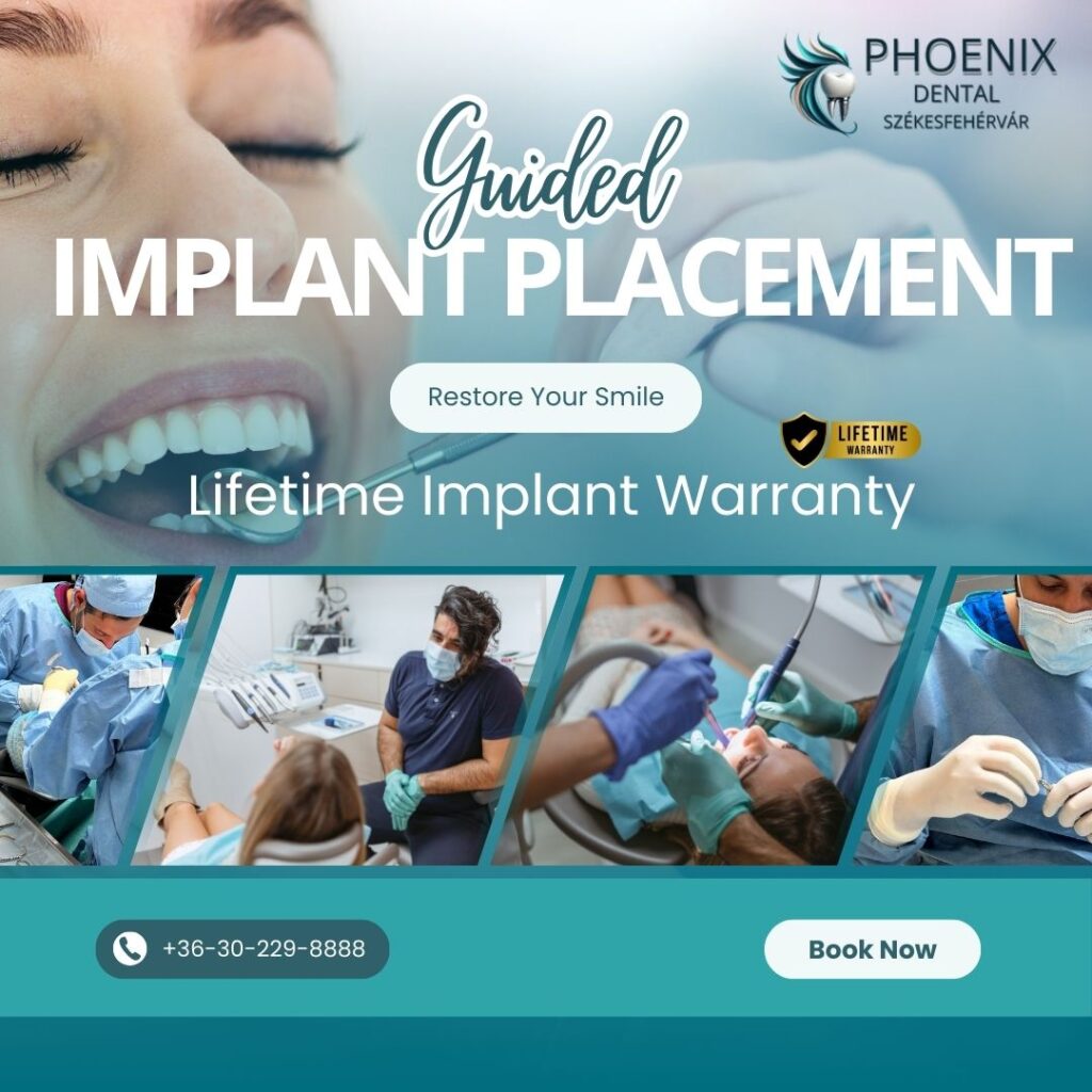 guided implant placement