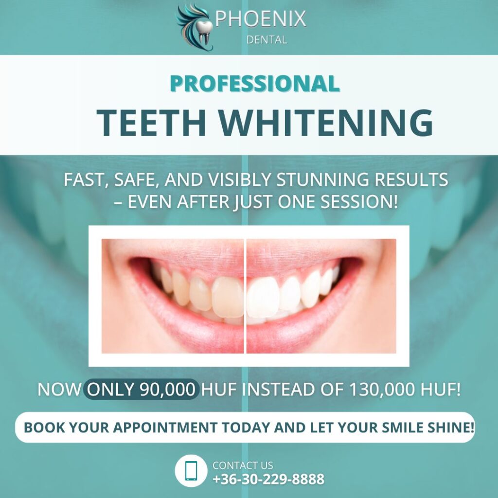teeth whitening special offer