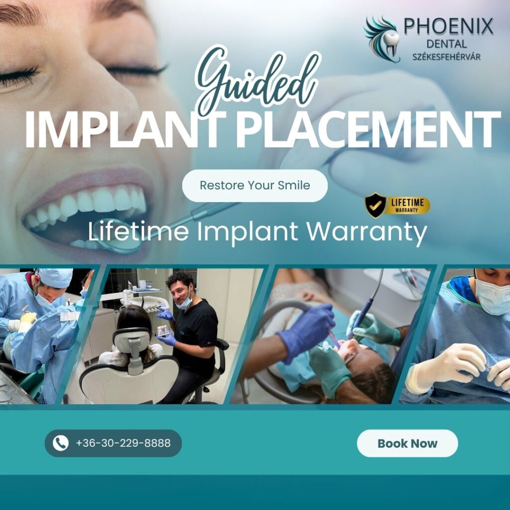 guided implant placement