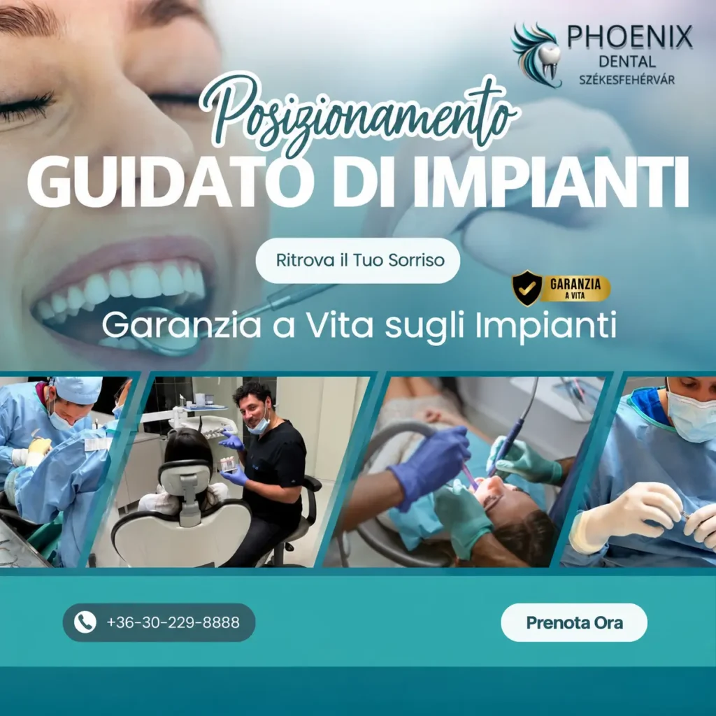 Posizionamento implantare guidato